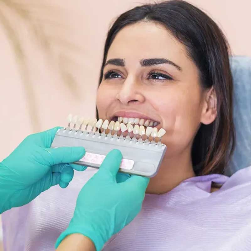 indirect and direct restorations